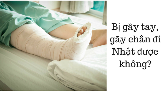 Bị gãy tay, gãy chân thì đi XKLĐ Nhật Bản đơn hàng nào?