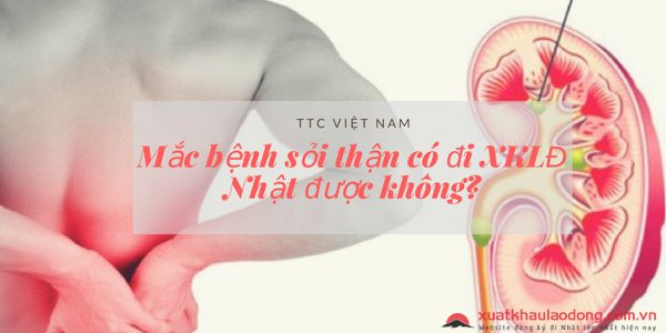 Mắc bệnh sỏi thận có đi XKLĐ Nhật được không?