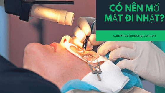 Có cần mổ mắt, tia mắt để đi XKLĐ Nhật Bản hay không?